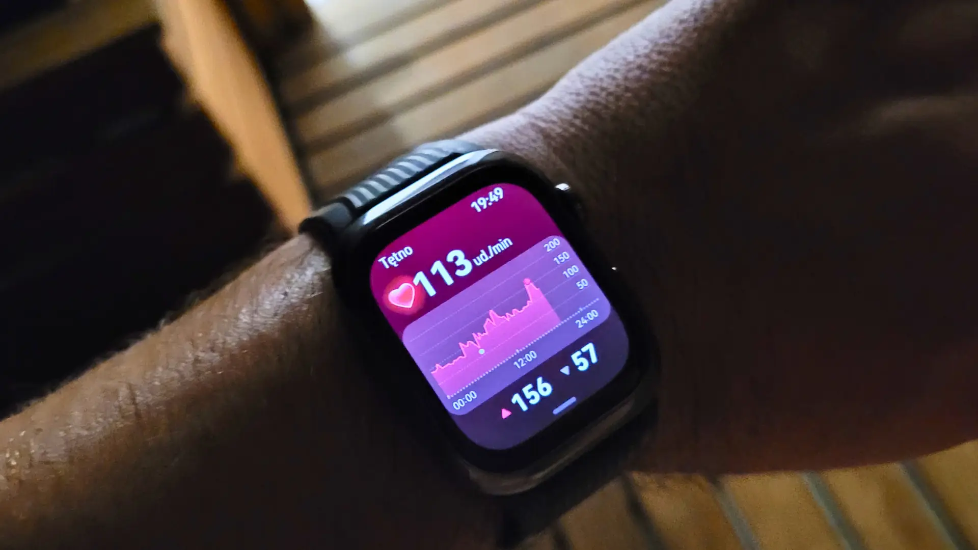 Huawei Watch D2 pomoże w monitorowaniu wysokości ciśnienia tętniczego